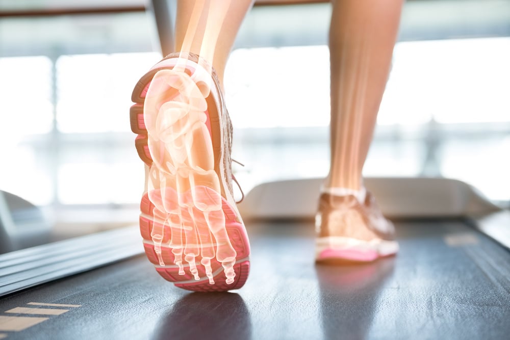 gait analysis and running physical therapy